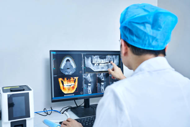 Best Emergency Dental Care for Broken or Chipped Teeth in Pine Grove, CA