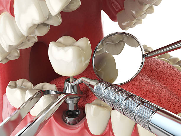 Best Emergency TMJ Treatment in Pine Grove, CA